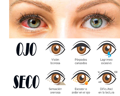 Síntomas de ojos secos